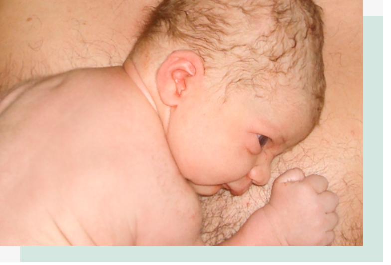 Neugeborenes Baby liegt direkt nach der Geburt auf der Brust der Mutter